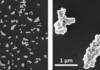 Biocompatible magnetic microparticles for cancer cells destruction